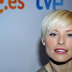 As&iacute; era el rostro de Soraya Arnelas poco despu&eacute;s de participar en Operaci&oacute;n Triunfo donde se dio a conocer.