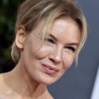 Con un rostro m&aacute;s natural que marca sus arrugas Rene&eacute; casi ha vuelto a ser la misma.