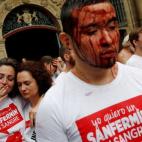 5c8b1bbf240000f404a41a7c