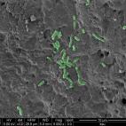 Listeria monocytogenes (en verde) en cecina de pavo.
