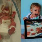 "Cuando llevaba 17 semanas embarazada, los médicos me dijeron que mi bebé se iba a morir. Era muy pequeño y no era capaz de asimilar los suficientes nutrientes para seguir creciendo. Yo no iba a rendirme, así que pasé el resto del embarazo ...