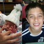 "Mi hijo Talan nació hace nueve años cuando yo estaba embarazada de 26 semanas: pesó 920 gramos. Tuvo que estar dos meses en la UCIN, pero todo fue muy bien. Superó los típicos orificios en las paredes del corazón, el sangrado cerebral, la...