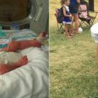 "Mi hijo Parker nació el 9 de julio de 2006, a las 30 semanas. Pesó 1,26 kilos y estuvo 49 semanas en la UCIN. Tener un hijo allí es lo peor y lo mejor que te puede pasar. Sigue habiendo desafíos que superar después de volver a casa. Es un ...