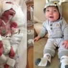 "Este es mi hijo, Jesse. Nació cuando yo estaba embarazada de 25 semanas y 6 días. Pesó 950 gramos y midió 34 centímetros, y llegó a pesar 350 gramos. Pasó 66 días en la UCIN, tuvo sus momentos duros, pero acabó pudiendo salir del hospi...