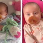 "Izquierda: en julio, cuando nació a las 32 semanas de embarazo. Derecha: ayer, con su peluche del hospital".