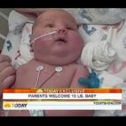 Wendi Dolton pesó al nacer 4,54 kilos, bastante para un bebé. Pero esta madre de Minnesota no imaginó que su futuro hijo le superaría: Axel vino al mundo con 7,08 kilos en noviembre de 2010.