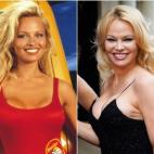 A&ntilde;o y edad de inicio en la serie: 1992 (25 a&ntilde;os)A&ntilde;o y edad de la foto: 2019 (52 a&ntilde;os)&Uacute;ltimo trabajo como actor: Nicky Larson et le parfum de Cupidon (2018)