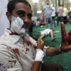 5c8aeae12300005400e7626c