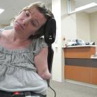 Katy Hayes de 44 años y de Texas, perdió todas sus extremidades por una fascitis necrotizante, una infección aguda provocada por la bacteria come-carne que ataca y devora al tejido celular subcutáneo. La mujer recibirá el primer trasplante ...