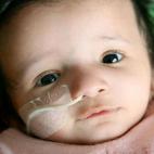 La bebé británica, Suraya Brown, sufre de una condición que no le permite crecer. Aquí los 14 meses, la pequeña tiene el tamaño de una recién nacida, pesando 7 libras y midiendo únicamente 19 pulgadas.