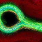 El año 2015 empezaba con la epidemia de ébola aún causando miles de muertes en África occidental, pero también con perspectivas prometedoras: durante una reunión de la Organización Mundial de la Salud (OMS) celebrada el 8 de enero en Gine...