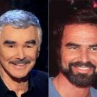 El áctor y cómico estadounidense, protagonista de Boogie Nights, ha explicado que se ha retocado los ojos (especialmente elevando los párpados), pero no ha querido dar más explicaciones, pese a los rumores y la apariencia de un lifting facial.