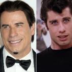 Del joven que no paraba de bailar en Grease y Fiebre del sábado noche al Travolta de hoy han pasado tres décadas, pero también varios retoques. Muchos bromearon con su rostro congelado en los pasados Oscars, cuando presentó en el escenario l...