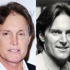 El medallista olímpico Bruce Jenner es más conocido fuera de su país por sus apariciones televisivas: es padre de Kendall y Kylie Jenner, y por tanto padrastro de las hermanas Kardashian. Se ha sometido a una rinoplastia y a más de un lifting.