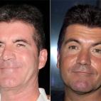 Conocido también por su papel de jurado en el concurso American Idol, el propio Cowell ha explicado no solo que se ha inyectado bótox, sino que esta sustancia forma parte de su rutina de belleza.