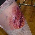 Las heridas pueden ser de todo tipo, desde mordiscos, hasta desgarros o arañazos.