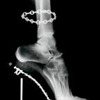 5c8b42252300000401247464