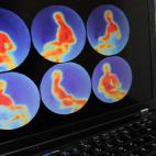 Cámara de seguridad, en Alemania, capaz de mostrar objetos peligrosos como armas o explosivos; una alternativa para los escáneres de seguridad en aeropuertos.