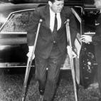 Kennedy sufría el llamado síndrome Schmidt, que provocaba náuseas, dolor abdominal, vómitos, pérdida de peso y musculatura, alta tensión, hipoglucemia, migrañas y carencias en el sistema inumne, entre otros síntomas.