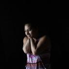 Angélica Murillo, de 37 años, en su casa en Tegucigalpa el 21 de agosto. El marido de Angélica la atacó en 2008, acusándola de tener una aventura, y le cortó las manos con un machete en un intento de homicidio.