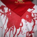 5c8b65af22000051001acdc4