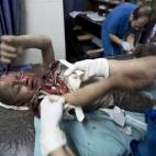 Un niño herido palestino recibe atención médica eb el hopistal al-Shifa de Gaza.
