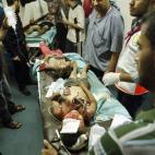 Niños heridos en un ataque aéreo israelí contra una vivienda en la ciudad de Gaza.