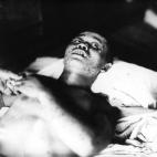 Un soldado de 21 años, atendido en un hospital militar de la ciudad,