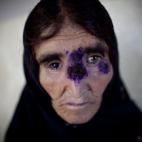 5c8aa8322300005400e6ea58