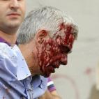 Francisco José Garzón Amo, maquinista del tren, con el rostro ensangrentado instantes después del accidente