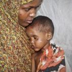 In this photo taken Tuesday, June 10, 2014, Somali mother Halimo Hussein holds her measles-infected daughter Nafisa Kulow, 4, in a ward at Banadir hospital in Mogadishu, Somalia. Somalia is suffering from an outbreak of measles that the World He...