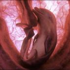 5c8aefec2400000a05a3ece9