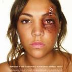 Miquita Oliver contra la violencia a las mujeres.