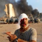 Fuerte explosión en el puerto de Beirut