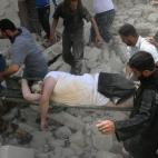 5c8aa7a92400004205a36d49