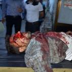 5c8aa7aa2400004205a36d4b