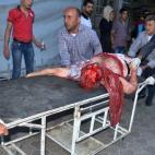 5c8aa7aa2500001304c962cf