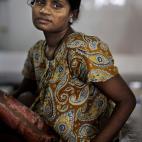 Shahi Noor, de 25 años, trabajaba en la sexta planta del Rana Plaza. Hubo que amputarle la pierna derecha para liberarla de los escombros.