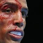 5c8b2fd7360000a61b6cad5d