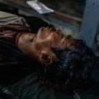 Uno de los fallecidos, en un hospital de la capital.