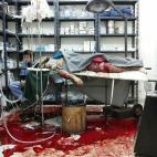 Un hombre gravemente herido yace en una mesa de operaciones en un hospital improvisado en un distrito asediado del este de Damasco. &quot;Dormir y descansar era un lujo imposible&quot;, decía el Dr. S., un joven cirujano que se graduó en los p...