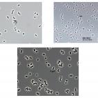 Fue uno de los hallazgos del año. La nueva bacteria 'Tersicoccus phoenicis' fue descubierta de forma casi simultánea en dos zonas muy alejadas entre sí pero que tenían mucho en común: las salas blancas de las estaciones espaciales de la NAS...