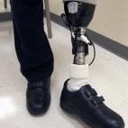 Aunque ya no existe el Cuerpo de Mutilados de Guerra procedente de la Guardia Civil, este organismo sigue recibiendo compensaciones para prótesis. En concreto, 17.000 euros. Idéntica partida que en 2015.