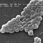 Acinetobacter baumannii