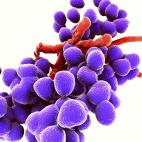 Enterococcus faecium