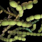 Streptococcus pneumoniae