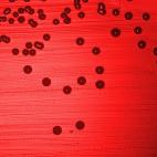 Haemophilus influenzae