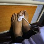 Los pies de una víctima del ataque. (AP Photo/Mohammad Sajjad)