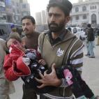 Una niña paquistaní herida en el ataque talibán a la escuela de Peshawar. (AP Photo/Mohammad Sajjad)
