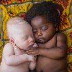 Un bebé albino de 3 semanas junto a su primo en Congo.